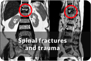 Senior woman holds the arm of a senior man as he walks with the help of a walker. They are looking at each other and smiling. Title reads: Hip Replacement