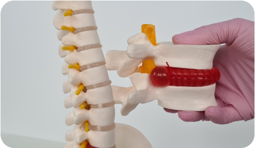 A young man is standing on a tennis court holding his shoulder and grimacing in pain. In his other hand he is holding a tennis racquet.