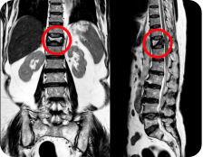 A senior man and woman outside on a sunny day. The man is leaning on a walker, and the woman is holding his arm affectionately. There are a lot of trees and other greenery in the background.